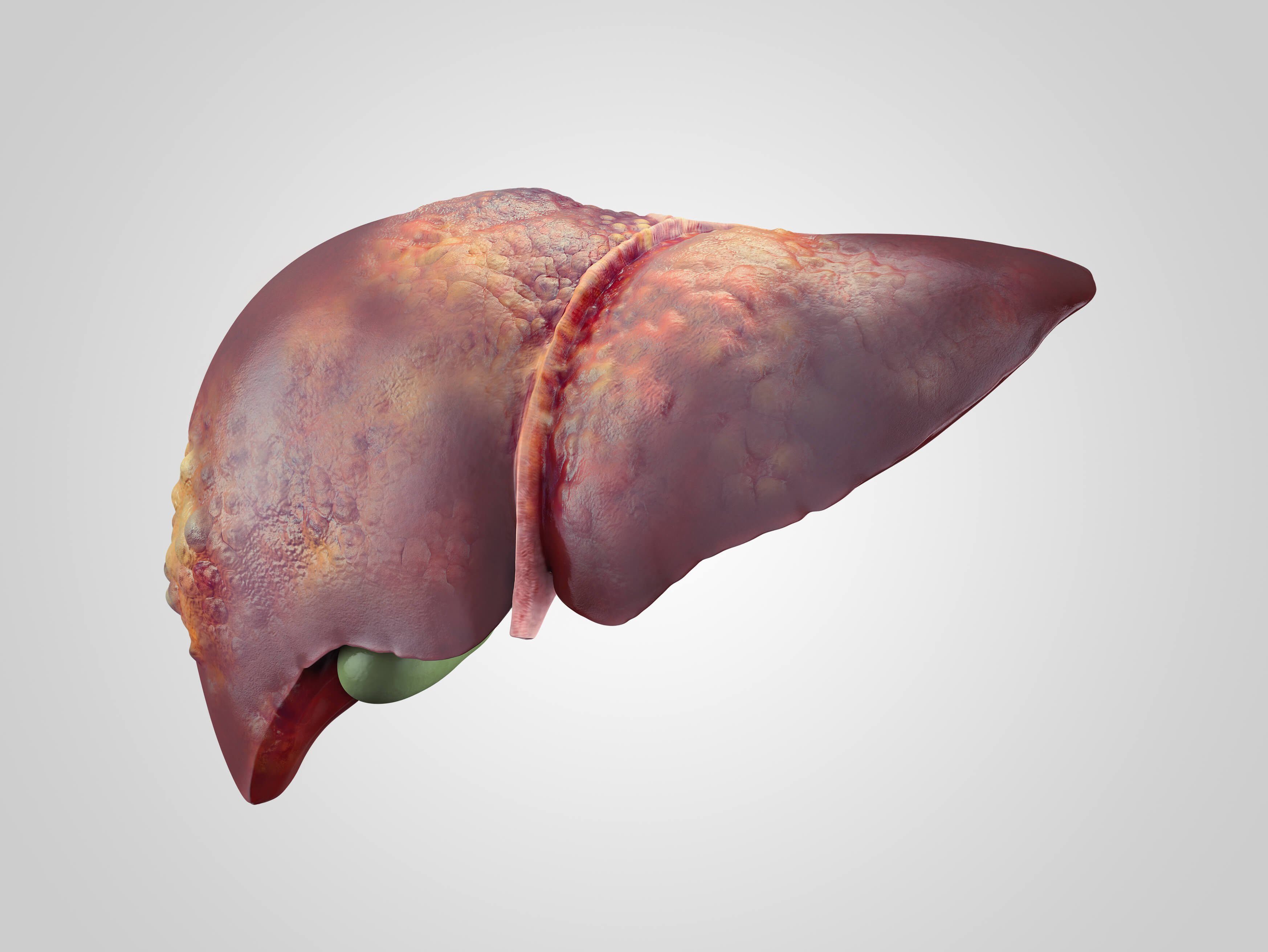 Liver Cancer Treatment Services In Denver Colorado